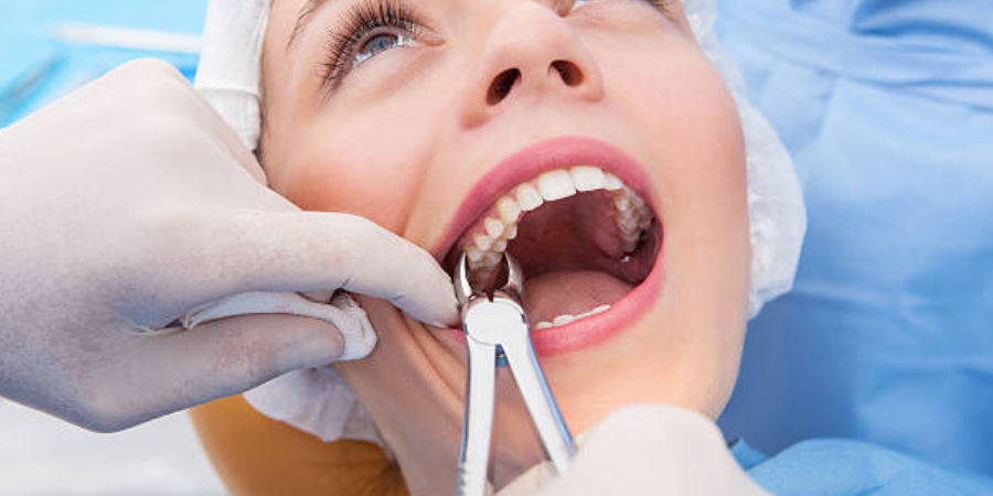 tooth extractions